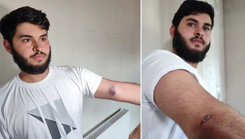 Bahçeye Kaçan Top, Mahallede Kargaşaya Neden Oldu: Kamyonet Olayı!